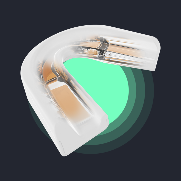 A scientifically validated Sleep Bruxism therapy in a custom-fit oral appliance 